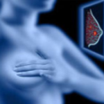 prevenzione digitale tumore al seno