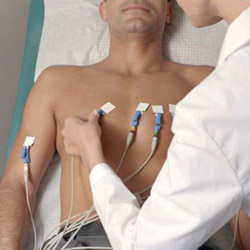 ECG